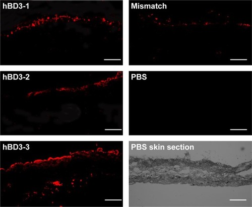 Figure 3 Skin penetration activity of hBD3-3 in vivo.Notes: Fluorescence microscopy of nude mouse skin sections 3 hours after application of PBS or rhodamine-labeled peptides. Sections were visualized using a rhodamine filter. Scale bar, 200 μm.Abbreviations: hBD3, human beta-defensin 3; PBS, phosphate-buffered saline.