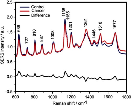Figure 1 The mean surface-enhanced Raman scattering (SERS) spectra of serum from controls and breast, colorectal, lung, ovarian and oral cancer samples (all types combined) and their spectral difference. All SERS spectra were mean normalized and for each spectrum, two measurements were averaged.