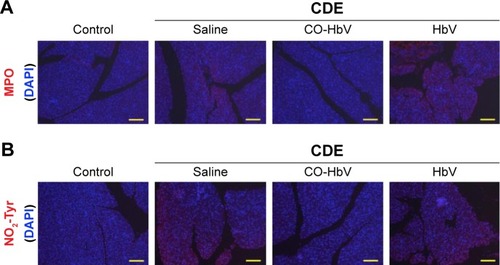 Figure 3 Immunological staining of pancreatic sections in CDE diet-induced acute pancreatitis mice.Notes: (A) Neutrophil infiltration was evaluated by immunostaining of MPO (red) in the pancreatic slices at 3 days after the start of the CDE diet; (B) immunostaining of pancreatic sections for the oxidative stress markers of amino acid, NO2-Tyr (red), at 3 days after the start of the CDE diet. DAPI (blue) was used to counterstain the nuclei. Scale bars represent 100 μm.Abbreviations: CDE, choline-deficient ethionine-supplemented; CO-HbV, carbon monoxide-bound hemoglobin vesicle; DAPI, 4′,6-diamidino-2-phenylindole; MPO, myeloper-oxidase; NO2-Tyr, nitrotyrosine.