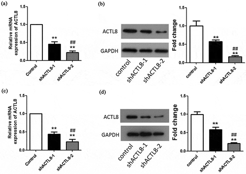 Figure 2. ACTL8 expression in EC cell lines and knockdown efficiency detection. (a–b) The mRNA and protein expression of ACTL8 in KLE cells transfected with PLKO.1 (control) or PLKO.1-sh ACTL8 (sh ACTL8) was detected by qRT-PCR (a) and western blot (b). (c–d) The mRNA and protein expression of ACTL8 in Ishikawa cells transfected with PLKO.1 (control) or PLKO.1-sh ACTL8 (sh ACTL8) was detected by qRT-PCR (c) and western blot (d). n = 6; **p < 0.01 vs. control group, ##p < 0.01 vs. sh ACTL8-1 group.