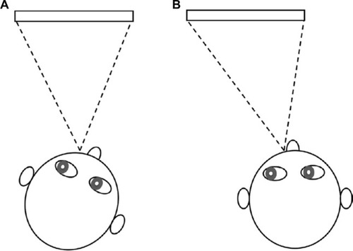 Figure 4 Example of environmental changes for a child with a left null zone (A). The child can be seated to on the right side of the classroom/television to place the eyes into the left gaze for a more comfortable head posture (B).