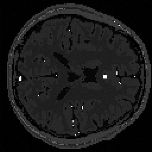 Fig. 2 A slice of simulated human brain with resolution 128 × 128.