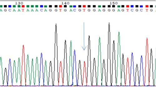 Figure 3 Homozygous TT sequencing map, arrow pointing to red single peak (location 144).