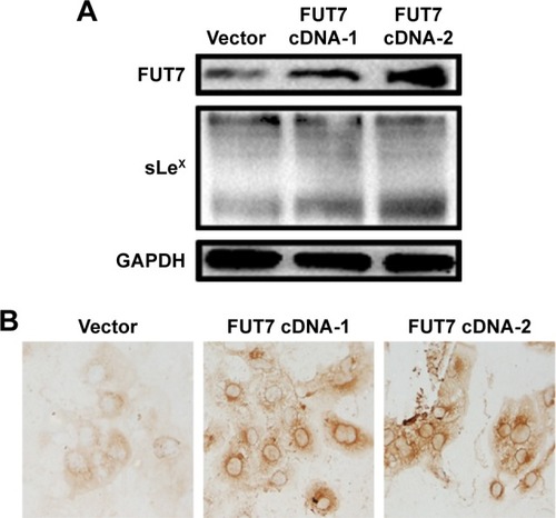 Figure 1 Overexpression of FUT7 increased the sLeX expression.