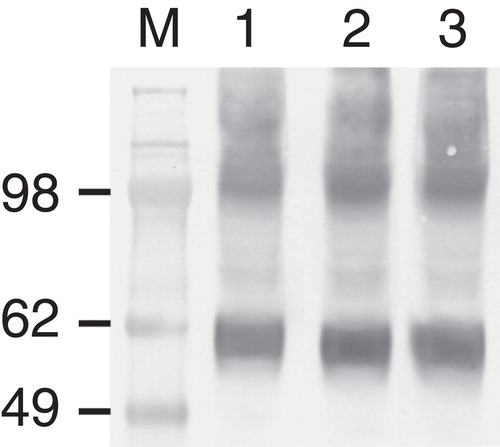 Figure 6. Cell-free production of SLC17A3-eGFP in the L-CF mode as shown by immunoblotting. Liposomes were added to CECF reaction batches and incubated at 26°C and 750 rpm over night. L-CF reaction mixtures were separated via PD-10 columns and aliquots of the elution fractions were loaded onto a gel. The synthesis of protein was detected via an anti-GFP antibody. The addition of liposomes did not inhibit the synthesis of SLC17A3-eGFP. M, molecular weight marker. (1) heart lipid liposomes; (2) liver lipid liposomes; (3) brain lipid liposomes.