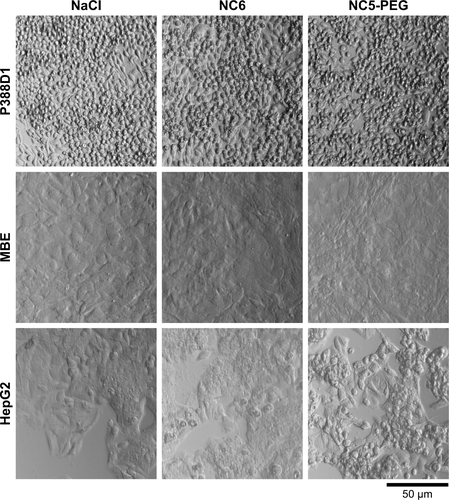 Figure S1 Morphology of various cell lines exposed to nanocapsules for 48 hours.Notes: The cells were grown for 48 hours in a medium containing 1.5 mM NaCl or nanocapsules (~2×1011/mL). Morphological changes were analyzed using the inverted light microscope LeicaDM IL LED Fluo.Abbreviations: NC5-PEG, five-layer PEGylated nanocapsules; NC6, six-layer nanocapsules; PEG, polyethylene glycol.