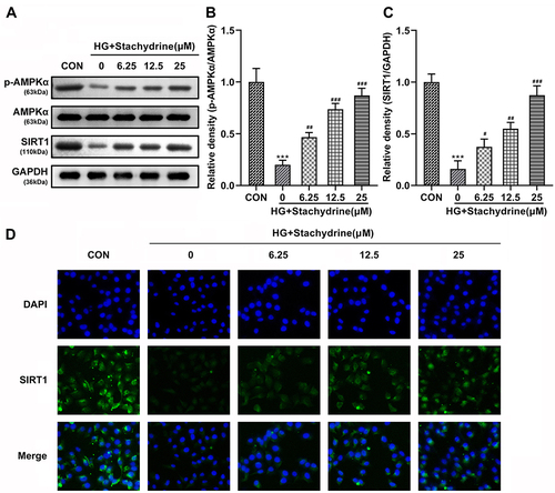 Figure 4 STA activated the AMPK/SIRT1 signaling pathway in the HG-treated HRMECs. (A–C) The Western blot results showed that protein levels of p-AMPKα, AMPKα and SIRT1 in the HG-stimulated HRMECs were increased after 6.25, 12.5 and 25 of STA treatment. (D) The immunofluorescence staining showed that SIRT1 levels in the HG-stimulated HRMECs were increased after 6.25, 12.5 and 25 of STA treatment. ***p<0.001. #p<0.05, ##p<0.01, ###p<0.001.