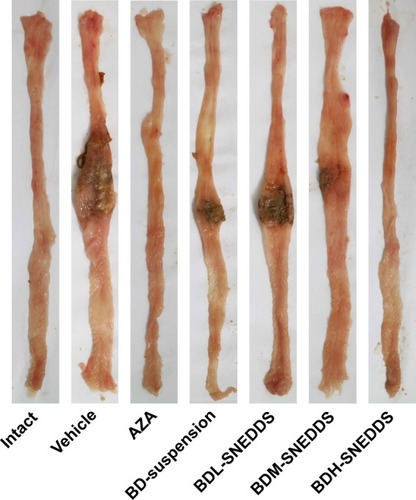 Figure 7 Effects of BD-SNEDDS on macroscopic changes in TNBS-induced UC in rats.Note: Data are expressed as mean±SD (n=6).Abbreviations: BD-SNEDDS, BD-loaded self-nanoemulsifying drug delivery system; AZA, azathioprine; TNBS, trinitrobenzenesulfonic acid; UC, ulcerative colitis; BDL-SNEDDS, low-dosage BD-loaded self-nanoemulsifying drug delivery system; BDM-SNEDDS, medium-dosage BD-loaded self-nanoemulsifying drug delivery system; BDH-SNEDDS, high-dosage BD-loaded self-nanoemulsifying drug delivery system.