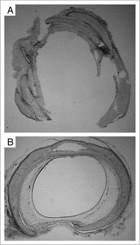 Figure 3 Histologic findings of rat tracheal allografts 28 days after transplantation. (A) a second allograft after transplantation of fresh allograft. The allograft is severely rejected. (B) a second allograft after transplantation of cryopreserved allograft. The patency of the allograft is narrow but the structure is maintained. (Hematoxylin and eosin; original magnification, ×25).