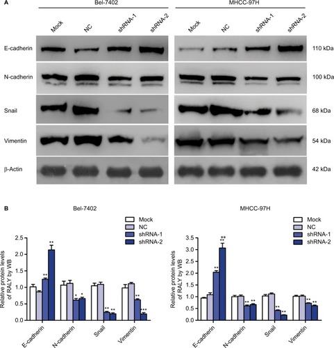 Figure 5 RALY knockdown caused changes in EMT marker expression levels in HCC cells.Notes: (A) Western blot analysis of EMT-related protein expressions in Bel-7402 and MHCC-97H cells. (B) Relative expression levels of EMT markers in Bel-7402 and MHCC-97H cells. Data represent the mean ± SEM of three independent experiments. *P<0.05, **P<0.01, ***P<0.001.Abbreviations: EMT, epithelial-to-mesenchymal transition; HCC, hepatocellular carcinoma; SEM, standard error of the mean; NC, negative control; WB, Western blotting.