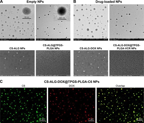 Figure 2 Physicochemical characterization of empty nanoparticles and drug-loaded nanoparticles. (A) TEM and SEM images of CS-ALG NPs and CS-ALG@TPGS-PLGA NPs. (B) TEM and SEM images of CS-ALG-DOX NPs and CS-ALG-DOX@TPGS-PLGA-VCR NPs. (C) The fluorescence images of CS-ALG-DOX@TPGS-PLGA-C6 NPs with CLSM.Notes: Green fluorescence originating from C6 shows TPGS-PLGA-C6 NPs; red fluorescence coming from DOX represents CS-ALG-DOX NPs; and the overlapping fluorescence of yellow originating from red plus green indicates CS-ALG-DOX@TPGS-PLGA-C6 NPs. Scale bar, 1 μm.Abbreviations: DOX, doxorubicin; VCR, vincristine; TPGS, D-α-tocopheryl polyethylene glycol 1000 succinate; PLGA, poly(lactic-co-glycolic acid); ALG, alginate; CS, chitosan; NPs, nanoparticles; TEM, transmission electron microscope; SEM, scanning electron microscope; CS-ALG-DOX NPs, chitosan-alginate nanoparticles carrying doxorubicin; TPGS-PLGA-VCR NPs, vitamin E D-α-tocopheryl polyethylene glycol 1000 succinate-modified poly(lactic-co-glycolic acid) nanoparticles carrying vincristine; C6, coumarin-6; CLSM, confocal laser scanning microscopy.