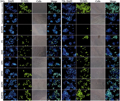 Figure 5. The fluorescence inversion microscope (FIM) images of apoptotic HepG2 cells induced by positive control (added DNase I), negative control (without any drug), BGPTN, FS, EMS, EPN, EPTN, EGPN and EGPTN after incubation for 24 and 72 h using TUNEL assays. Only apoptotic cellular nuclei displayed green fluorescence while all the nuclei were blue stained by DAPI.