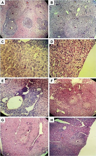 Figure 2 Histopathological study of H&E-stained liver sections of different groups of mice infected with Schistosoma mansoni.Notes: Infected untreated group showing: (A) multiple granulomas of variable sizes and shapes with preserved hepatic architecture (×100); (B) cellular granuloma composed of lymphocytes, histiocytes, epithelioid cells, and eosinophil cells, surrounding the bilharzial egg (×400); (C) Kupffer cell hyperplasia and bilharzial pigment (×400); (D) fatty changes in hepatocytes (×400); (E) hepatic sinusoids with lymphocytic infiltration (×400); and (F) infected PZQ suspension-treated mice (×100); (G) infected PZQ–LNC-25-treated mice (×100), and (H) infected PZQ–OA–MFS–LNC-25-treated mice (×100) showing small cellular granulomas with mild amelioration of liver pathology.Abbreviations: LNC, lipid nanocapsules; MFS, miltefosine; OA, oleic acid; PZQ, praziquantel.