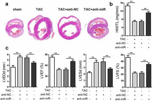 Figure 6. miR-337-5p silencing inhibits cardiac hypertrophy in vivo. (a) HE staining of the heart tissue was performed to analyze cardiac hypertrophy. (b) The ratio of heart weight to tibial length (HW/TL) was calculated. (c) Cardiac function was evaluated by assessing LVEF, LVFS, LVEDd, and LVESd. **p < 0.01