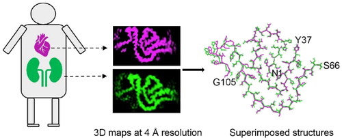 Figure 1. Cartoon showing identical maps and structures of cardiac and renal amyloid fibrils of AL55 LC.