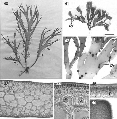 Figs 40–46. Gracilaria multipartita. Habit and vegetative structure. Fig. 40. Habit of an adult specimen with many ligulate marginal proliferations (arrows) (HGI–A 10230). Fig. 41. Female gametophyte with cystocarps (HGI–A 16029). Fig. 42. Branch of female gametophyte with protruding cystocarps (HGI–A 16029). Fig. 43. Cross-section through median part of thallus (HGI–A 16029). Fig. 44. Cross-section showing progressive transition between medullary and cortical layers (HGI–A 16029). Fig. 45. Darkly staining multinucleate surface cells (HGI–A 16029). Fig. 46. Apex of thallus in surface view (HGI–A 2300). Scale bars: Figs 40, 41 = 5 cm; Fig. 42 = 1 cm; Fig. 43 = 200 µm; Figs 44–46 = 20 µm. Figs 43–45, haematoxylin. Abbreviations: cy = cystocarp; n = nucleus.