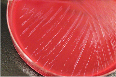 Figure 4 Colony morphology of the present strain on Brucella HK agar plate.