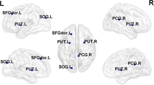 Figure 3 Differences in nodal local efficiency and degree centrality (DC) among subjective cognitive decline with APOEε4 (SCD+), subjective cognitive decline without APOEε4 (SCD−) and normal control without APOEε4 (NC−). The statistical criterion for groups was set at P<0.05, uncorrected.