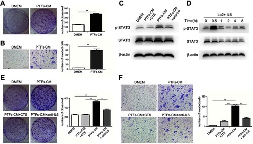 Figure 5 Effects of PTFs on the growth and migration of L-02 cells in vitro.Notes: (A+B) DMEM and PTFs-CM cultured L-02 cells were assessed by colony forming assay (A) and transwell assay (B) to examine cell proliferation and migration. (C) Western Blot analysis showed that PTFs induced the activation of STAT3 signaling in L-02 cells. Both CTS and IL-6 neutralizing antibody could reduce the effect. (D) L-02 cells were incubated with IL-6 (40 ng/ml). (E+F) L-02 cells cultured in PTFs-CM were treated with CTS or IL-6 neutralizing antibody for 24 h respectively. Then the cells were subjected to colony-forming assay (E) and transwell assay (F). Scale bar, 200 µm. Data are shown as mean ± SD from at least three independent experiments (*P<0.05, **P<0.01, ***P<0.001).Abbreviations: CM, conditioned medium; CTS, cryptotanshinone; PTFs, peri-tumor fibroblasts.