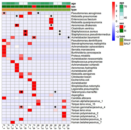 Figure 4 Comparison of pathogens detected by blood and BALF mNGS in patients with sepsis secondary to pulmonary infection; Each row on the vertical plane represents a sample, and each row on the horizontal plane represents potential pathogenic bacteria; The top is the clinical phenotype, and the color block on the right represents the specific value of the clinical phenotype.+, mNGS and BALF detected the same pathogenic bacteria.