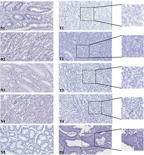 Figure 8. RNA scope assay targeting circRNA0047905 evaluation in histological samples.