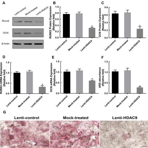 Figure 2 Knockdown of HDAC9 inhibited the osteogenic differentiation of hBMSCs. (A–C) The expression of RUNX2 and OCN proteins was determined by Western blotting analysis after osteogenic differentiation for 14 days. (D and E) The expression of Runx2 and OCN mRNA was determined by qRT-PCR at day 14 of osteogenic differentiation. (F) Mineralization was quantified by the extraction of Alizarin Red S-stained cells. (G) Alizarin Red S (ARS) staining after osteogenic differentiation for 14 days. Scale bar =50μm. Data were mean ± S.D. *P<0.05 versus the lenti-control group.