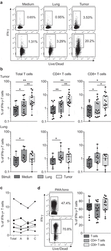 Figure 2. Most NSCLC-derived TIL products contain tumor-reactive T cells. (a, b) REP TILs were pre-stained with CD4 and CD8 antibodies, and cultured for 6 hours in the presence of brefeldin A with medium alone, with digests from normal lung tissue, or with autologous tumor digest. (a) Representative dot plots, and (b) compiled data of TIL products derived from 17 donors (top), and of T cells expanded from non-tumorous lung tissue from 11 donors (bottom). The percentage of IFN-γ producing CD3+ T cells (left panel), by CD4+ T cells (middle panel) and by CD8+ T cells (right panel) is depicted as determined by flow cytometry. Each dot represents one donor, box and whisker plots depict the median (line), minimum and maximum values (whiskers) and 25th pct and 75th pct (box). (c) TILs of 6 donors were expanded from the total digest, or from three distinct regions of the tumor lesion (region A,B,C). IFN-γ production of the different TIL products was compared after 6h of culture with the total tumor digest. (d) IFN-γ production by CD4+ and CD8+ T cells upon activation with PMA-Ionomycin. [Paired student’s T test; * p < .05; ** p < .01; *** p < .001. If no indication, p ≥ 0.05].