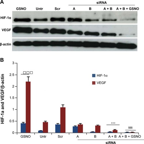 Figure 5 Effects of GSNO on expression of HIF-1α and VEGF in HIF-1α-silenced endothelial (bEnd3) cells.