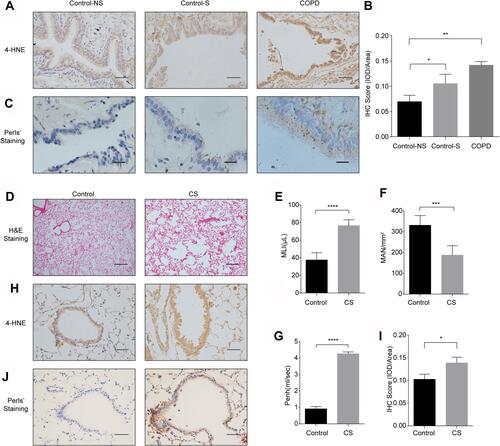 Figure 1 Ferroptosis is involved in human and murine COPD lung tissues. (A) Immunohistochemical (IHC) staining of 4-HNE in lung tissues from healthy volunteers (Control-NS), healthy smokers without COPD (Control-S) and COPD patients (original magnification ×400). Bar: 50 μm. The results were scored by (B) the integrated optical density (IOD)/area. (C) Fe3+ deposits were stained with Perls’ DAB in lung tissues from Control-NS, Control-S and COPD patients (original magnification ×400). Bar: 20 μm. (D–I) C57BL6 mice were exposed to room air (Control) or cigarette smoke (CS) for 6 months. (D) H&E staining in lung sections of mice in the control and CS groups (original magnification ×100). Bar: 200 μm. At least 3 areas in tissues collected from each mouse were captured, and 3 mice in each group were analyzed. (E and F) The alveolar size was measured by the mean linear intercept (MLI) and mean alveolar number (MAN) at ×100 magnification. (G) Enhanced pause (Penh) of room air- and CS-exposed mice. (H) IHC staining of 4-HNE from lung sections of room air- and CS-exposed mice (original magnification ×400). Bar: 50 μm. The results were scored by (I) the IOD/area. (J) Fe3+ deposits were stained with Perls’ DAB in air-exposed mice and CS-exposed mouse lungs (original magnification ×400). The results are presented as the means ± S.E.M. for three independent experiments. *P<0.05; **P < 0.01; ***P < 0.001; ****P < 0.0001.