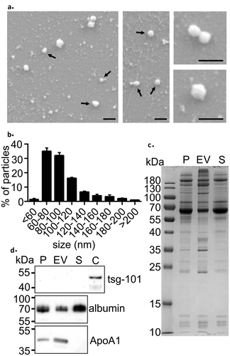 Figure 1. Characterisation of EVs isolated using the precipitation method. (a) Scanning electron microscopy (SEM) images of the isolated EV fraction show round vesicle-like particles (black arrows) and smaller background particles. Scale bar: 200 nm in all panels. (b) Nanoparticle tracking analysis (NTA) showed that the size of most particles ranged from 60–120 nm, which is comparable to that measured with SEM. Data are expressed as the mean ± standard error of the mean. (c) SDS-PAGE of proteins in trunk plasma (P), EV pellet (EV), and the remaining supernatant (S). Each lane was loaded with 5 µg protein. Note that almost all protein bands present in plasma were also observed in the EV-pellet. (d) Western blot analysis showed no signal on EV-marker tsg-101, reduced signal in the albumin and enrichment of the HDL marker ApoA1 in the EV pellet. Rat cortex lysate (C) was used as a positive control for tsg-101.