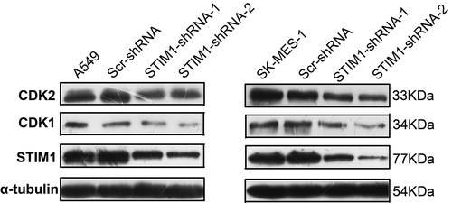 Figure 5. Expression of cell cycle-related molecules in NSCLC cells with STIM1 knockdown. CDK1 and CDK2 were significantly downregulated after knockdown of STIM1 expression in A549 and SK-MES-1 cells. *p < 0.05 by Student’s t-test. STIM1, stromal interaction molecule 1; NSCLC, non-small-cell lung cancer.