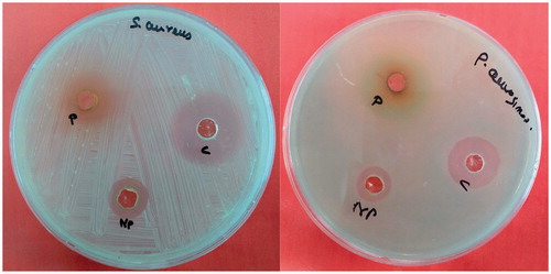 Figure 5. Antibacterial activity of R. palmatum and biosynthesized AgNPs. P - plant extract; C - control (streptomycin); NP - green synthesized silver nanoparticles.