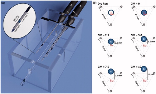 Figure 1. (a) A target device which ensured a standardised positioning of the applicators (‘A’) to the vessel (glass tube, ‘G’), was used for comparability of the experiments. It assisted in cutting the ablations exactly at the largest cross-sectional areas. Two electrodes are situated on each applicator, therefore six electrodes are used simultaneously in this multipolar configuration. (b) Five different applicator-to-vessel geometries (GM =0, 2.5, 5.0, 7.5 and 10) were tested. The coagulation zones were compared to a ‘dry run’ without saline perfusion but with a centrally placed vessel.