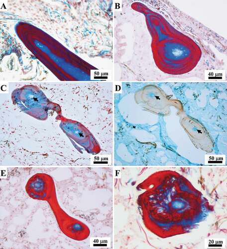 Figure 6. Sarcotragus spinosulus. LM photo-micrographs of skeletal histological sections. (A-C). Fibres with plurilamellar structure of bark (red) alternating with layers of amorphous matrix (blue) and amorphous non-laminated central core (light blue, blue-colourless) (arrows in C indicating the colourless inner core) (A, sagittal section; B, C, cross-section, Masson trichrome). (D). Fibres with a colourless laminated bark and turquoise innermost core (arrows) (cross-section, Alcian blue). (E-F). Fibres showing irregular scalloped outlines and a degenerating appearance of the bark (red) in the remodelling phase (cross-section, Masson trichrome). (C-D successive sections of the same fibre)