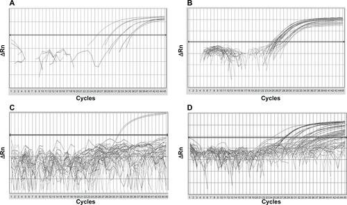 Figure S1 Amplification plots representing the quantitative methylation-specific results.Notes: (A) Calibration curves constructed by serial dilutions (90–0.009 ng) of a leukocyte DNA methylated in vitro. (B) Amplification of all samples by the reference gene ACTB. (C) A frequently unmethylated gene showing the amplification of the positive control only (leukocyte DNA methylated in vitro). (D) A frequently methylated gene.