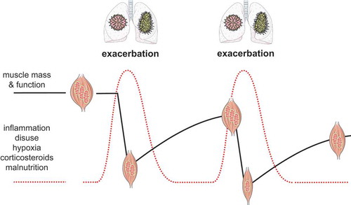 Figure 2. Conceptual visualization of the step-wise decline of muscle mass, OXPHEN (reflected by the mitochondria) and function in COPD due to (recurrent) exacerbations. Muscle wasting and loss of function are accelerated during an exacerbation in response to acutely increased levels of COPD-related triggers of muscle dysfunction. During the recovery phase muscle regeneration is intrinsically impaired in COPD or incomplete due to a recurrent exacerbation