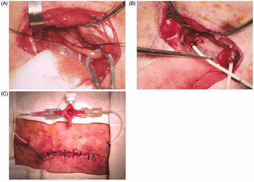 Figure 2. The operative procedure for reversible PUUO. (A) The right ureter was exposed. (B) Two F6 ureteral catheters were implanted and fastened into ureteral stumps. (C) Two F6 ureteral catheters were connected by a tee joint valve.