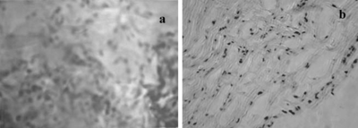 Figure 1 Seeded cells dispersed through collagen/chitosan matrices in EDE after 24 hours culture. A) Three-dimensional equivalents stained with neutral red (original magnification × 250). B) Cryostat section stained with H + E, note that no microvessel-like tubes were formed in equivalents at this time (original magnification × 100).