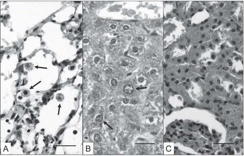 Figure 1.  Tissue samples from rats treated with 7.0 mg MCT/kg by gavage daily for 14 days. (A) The pulmonary alveolar lumen reveals enhanced quantities of macrophages (arrows). (B) In the liver, an increased presence of megalocytosis within hepatocytes (arrows) was observed. Finally, in the renal samples (C), only a mild presence of diffused congestion is visible. Bar = 35 μm.