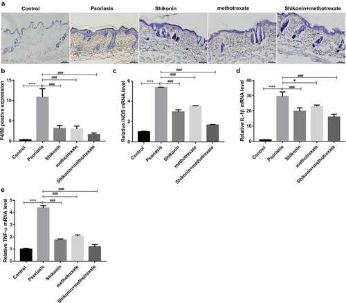 Figure 3. Shikonin combined with methotrexate regulated macrophage polarization in imiquimod-induced psoriasis mice. Macrophage infiltration in skin lesion tissue from mice in Control, psoriasis, shikonin, methotrexate and shikonin + methotrexate groups was observed under immunohistochemistry via staining by F4/80, and optically photographed (a). The statistical data showed the F4/80 positive expression (b) from (A). The mRNA expressions of macrophage M1-type markers iNOS (c), IL-1β (d), TNF-α (e) in skin lesion tissue from mice in Control, psoriasis, shikonin, methotrexate and shikonin + methotrexate groups. Scar bar = 50 µm, ***p < 0.001 vs. Control group. #p < 0.05 and ###p < 0.001 vs. psoriasis group.