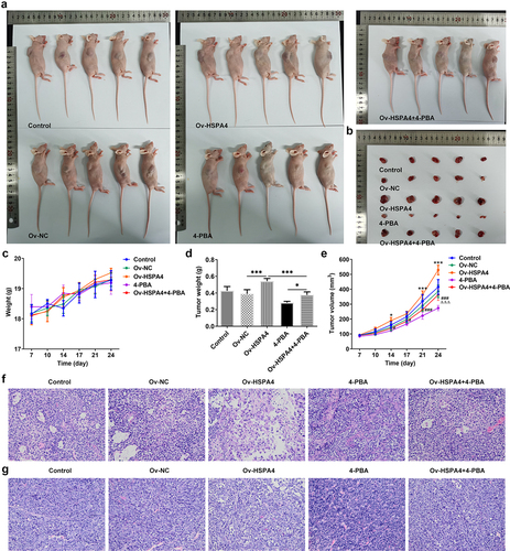 Figure 7. HSPA4 overexpression aggravates TNBC tumor growth in vivo. (a) (b), mice and tumor tissues transfected with or without Ov-HSPA4 in the presence or absence of 4-PBA. Body weight (c) and tumor weight (d) of mice were detected. *P < 0.05, ***P < 0.001. (e) Tumor volume was measured twice a week. *P < 0.05, ***P < 0.001 versus Ov-NC. #P < 0.05, ###P < 0.001 versus Ov-HSPA4. ΔΔΔP < 0.001 versus 4-PBA. (f) (g), Tumor tissues and lymph nodes were observed by H&E staining. Original magnification 200 ×. Data are expressed as mean ± SD.