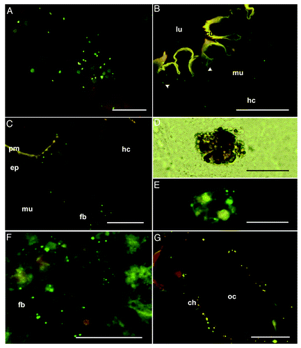 Figure 4. Analysis of the maternal transfer of bacteria in G. mellonella by fluorescence microscopy (A) Artificial diet mixed with fluorescently-labeled E. coli (green spots), cryo-section, scale bar = 50 μm. (B–C) Final-larval instar (stage V) fed with bacteria-contaminated diet. (B) Higher magnification of the foregut epithelium to show fluorescent E. coli beneath the cuticle. Ingested bacteria (green spots) are scattered in the epithelium (arrowhead), in the intercellular space between the epithelium and muscular tissue, and in the musculature and hemocoel, cryo-section, scale bar = 100 μm. (C) Fluorescence images of the midgut region showing translocated labeled bacterial probes (green spots) in association with the midgut epithelium as well as the fat body cells in the hemocoel, cryo-section, scale bar = 100 μm. (D–F) Pupal stage injected with labeled bacterial probes. (D) Higher magnification shows additional distributed nodule formations of circulating hemocytes in the pupal hemocoel, cryo-section, scale bar = 50 μm. (E) Nodules include bacterial probes (green spots), cryo-section, scale bar = 50 μm. (F) Bacteria attached to the fat body of pupae, cryo-section, scale bar = 100 μm. (G) Oviposited eggs of females injected with fluorescent bacteria during final-instar stage. The oocyte is lined with a chorion containing fluorescent E. coli (green spots), cryo-section, scale bar = 100 μm. Fluorescent photomicrographs were acquired with overlays of DSR and GFP2 fluorescence filters to optimize fluorescence visualization. Abbreviations: ch, chorion; cu, cuticle; ep, epithelium; fb, fat body; hc, hemocoel; lu, gut lumen; mu, musculature; oc, oocyte; pm, peritrophic membrane.