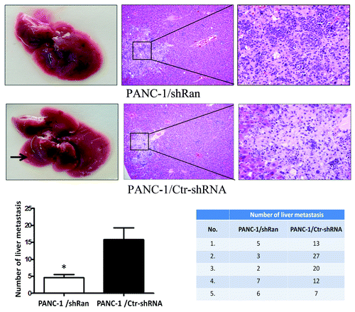 Figure 3. Ran promotes the metastatic ability of pancreatic cancer cells in vivo. Nude mice were tail vein-injected with 1 × 106 PANC-1/ shRan cells and PANC-1/Ctr-shRNA cells. All mice were sacrificed 42 d later after injection of tumor cells and examined for metastatic liver nodules. Representative images of liver tumor metastases. Metastatic loci were identified and marked by arrows; the liver tissues were sectioned serially and then stained with H&E. The number of liver metastasis data are shown in histograms. The values represent the mean (SEM) from at least three separate experiments. *P < 0.05.
