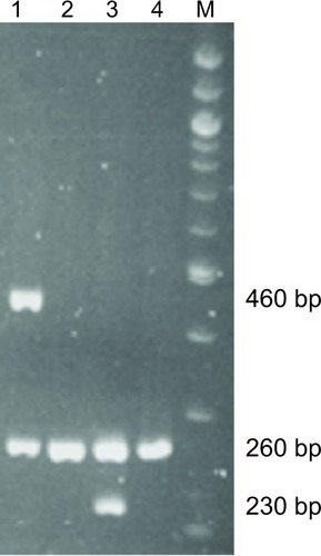 Figure 1 Genotyping of GSTM1 and GSTT1 using polymerase chain reaction. M, 100 bp DNA marker. Lane 1: GSTT1 present (460 bp) genotype and β-globin (260 bp). Lane 2: GSTT1 null genotype and β-globin (260 bp). Lane 3: GSTM1 present genotype (230 bp) and β-globin as an internal control (260 bp). Lane 4: GSTM1 null genotype and β-globin (260 bp). Present: subjects with homozygous or heterozygous wild-type allele(s). Null: subjects with homozygous deleted alleles.