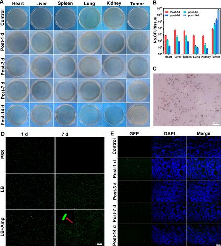 Figure 4 Bacterial colonization in MDA-MB-231-bearing mice after i.v. injection. (A) Representative photographs of solid LB agar plates of bacterial colonization in various organs at different time points after injection of E. coli BL21(AI). (B) Quantification of bacterial colonization in various organs of MDA-MB-231-bearing mice at different time points after injection of E. coli BL21(AI). (C) Optical microscope image of gram stain of a monoclonal colony from the LB plates (400 × magnification), the scale bar is 25 µm. (D) Representative CLSM images of GFP-E. coli under different culture conditions at 37 °C, the scale bar is 50 µm. The red arrow marks the GFP-E. coli (1200 × magnification). (E) Representative CLSM images of GFP-E. coli growth in tumors at different time points after i.v. injection, the scale bar is 100 µm.