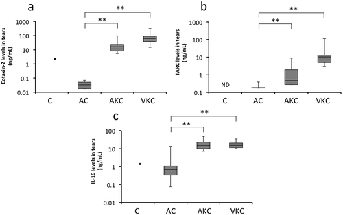 Figure 1. Determination of chemokine levels in tears by using the magnetic bead assay. Tear levels of CCL17/TARC (A), CCL24/eotaxin-2 (B), and IL-16 (C) in patients with AKC and VKC are significantly higher than those in patients with AC; *p < 0.05, **p < 0.01. AC: allergic conjunctivitis, AKC: atopic keratoconjunctivitis, VKC: vernal keratoconjunctivitis, TARC: thymus and activation-regulated chemokine, IL-16: interleukin-16, ND: not detected.