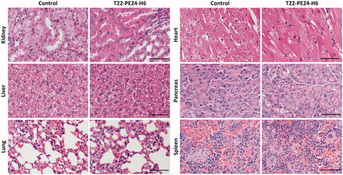 Figure 7. Lack of histological alterations in normal and colonized organs of mice treated with T22-PE24-H6. Representative images of H&E staining in normal organs (kidney, heart, pancreas, and spleen) and in metastasis-affected organs (liver and lung). These organs were collected 24 hours after the last buffer or T22-PE24-H6 administered dose of the repeated administration schedule (5 µg of T22-PE24-H6, 18 total doses, three times per week) in NSG mice orthotopically injected with the CXCR4+ SW1417 CRC cell line. Scale bars: 100 µm.