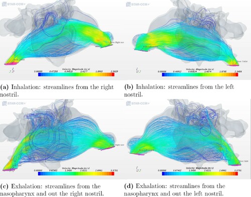 Figure 6. Airflow patterns for geometry 5 as indicated by streamlines during inhalation and exhalation.