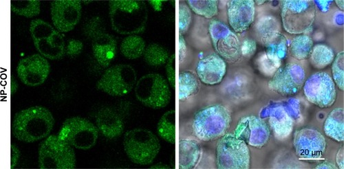 Figure 2 Uptake study with OV-loaded NPs.Notes: (A) The effect of antibody-decorated PLGA NPs on DC uptake assessed by flow cytometry. (a–d) Overlay of the histograms of untreated cells (red), cells treated with plain NPs (green), and cells treated with Ab-modified NPs (purple) for 0.18 iv COOH and 0.55 iv COOH groups with and without BS. (e–h) Overlay of the histograms representing DC uptake of 0.15 iv ester- and 0.55 iv ester-terminated NPs being formulated with and without BS. Histograms are representative of three individual experiments. (B) Bar diagram showing comparative fold increase in MFI of plain NPs and DCs treated with Ab-modified formulations for 0.18 iv COOH, 0.55 iv COOH, 0.15 iv ester, and 0.55 iv ester-terminated NPs, respectively. MFI for different NPs has been compared considering untreated cells (coumarin-6 only) as 1. All the studies were done in triplicate (p<0.05). (C) Representative overlapped CLSM images for coumarin-6 loaded NPs (0.18 iv COOH only) in DCs. Blue color represents the DAPI-stained nuclei which are encompassed by green fluorescence for the groups treated with coumarin-6-loaded NPs.Abbreviations: Ab, antibody; AD, adsorption; BS, bis(sulfosuccinimidyl) suberate; C, COOH; CLSM, confocal laser scanning microscopy; COV, covalent; DAPI, 4′,6-diamidino-2-phenylindole; DC, dendritic cell; E, ester; iv, inherent viscosity; MFI, mean fluorescence intensity; NPs, nanoparticles; OV, ovalbumin; PLGA, poly-lactic-co-glycolide.