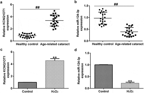 Figure 2. Effects of H2O2 on miR-124-3p and KCNQ1OT1 level in SRA01/04 cells.